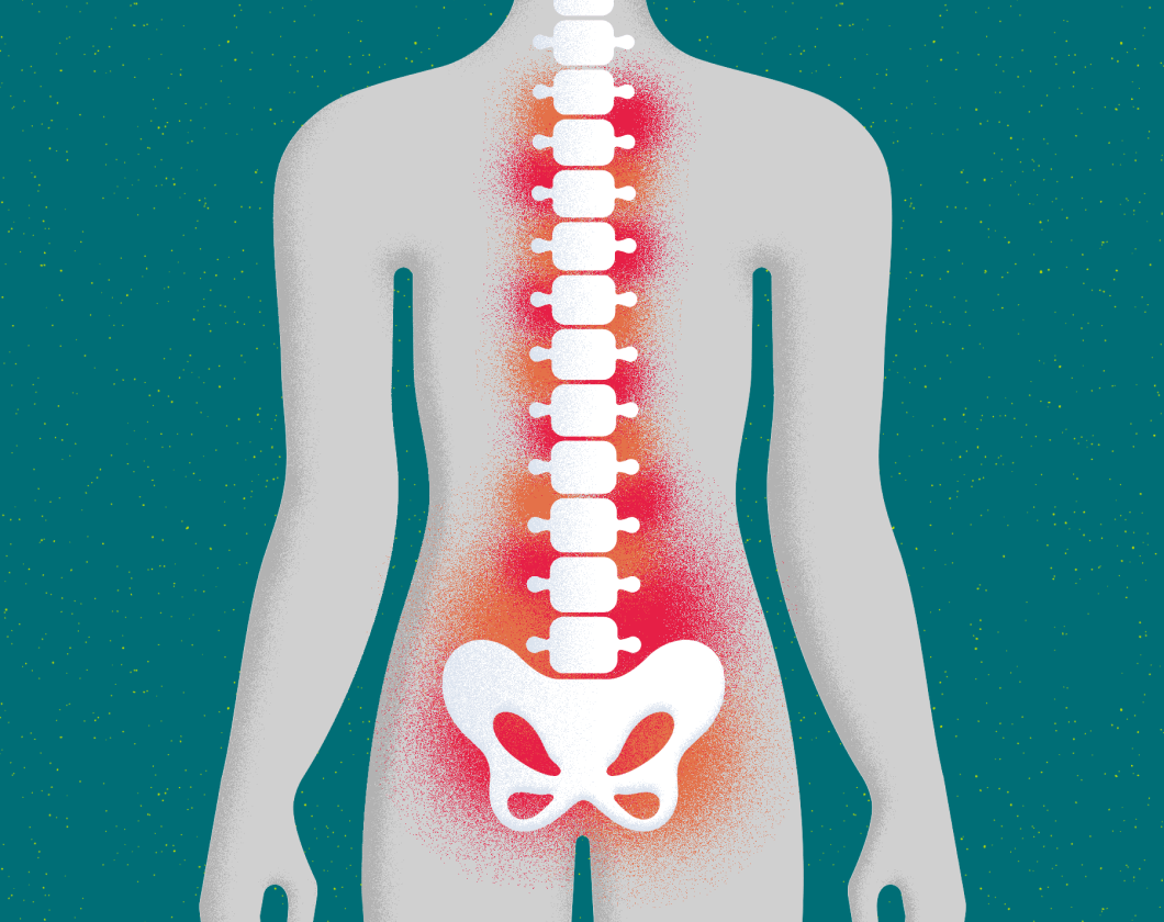 What is AS inflammation