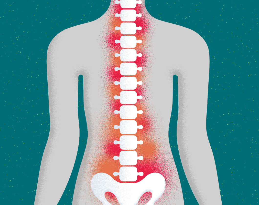 What is nraxSpA inflammation