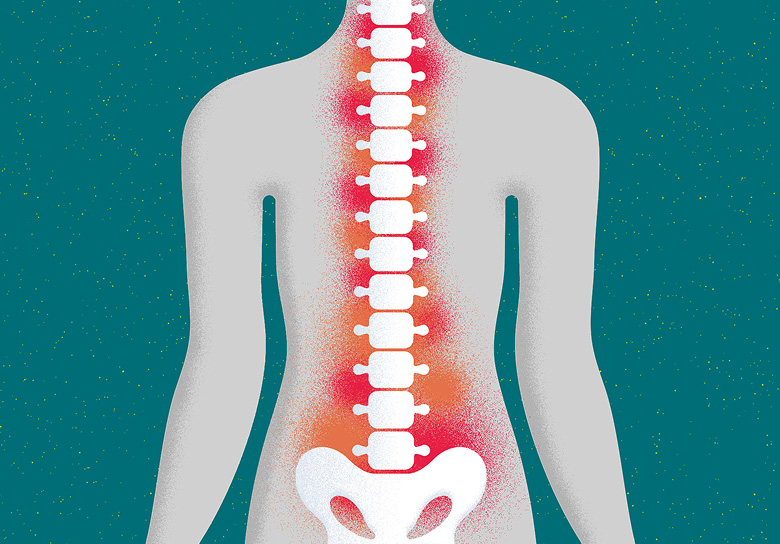 What is nraxSpA inflammation